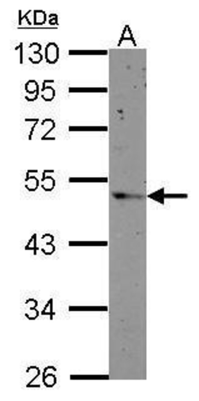 ANTI-PRSS35