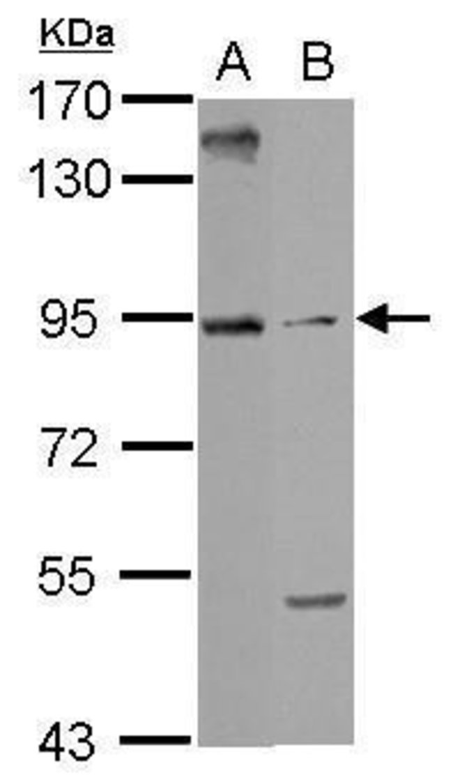 ANTI-ARMC3