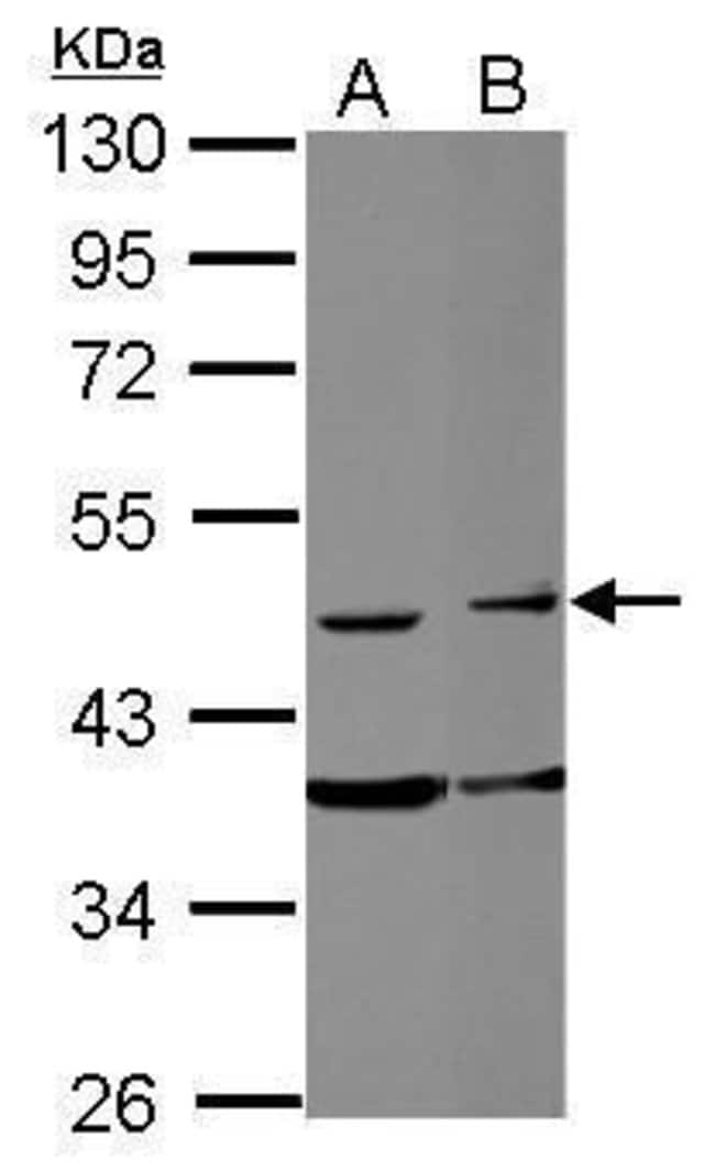 ANTI-FAM98B