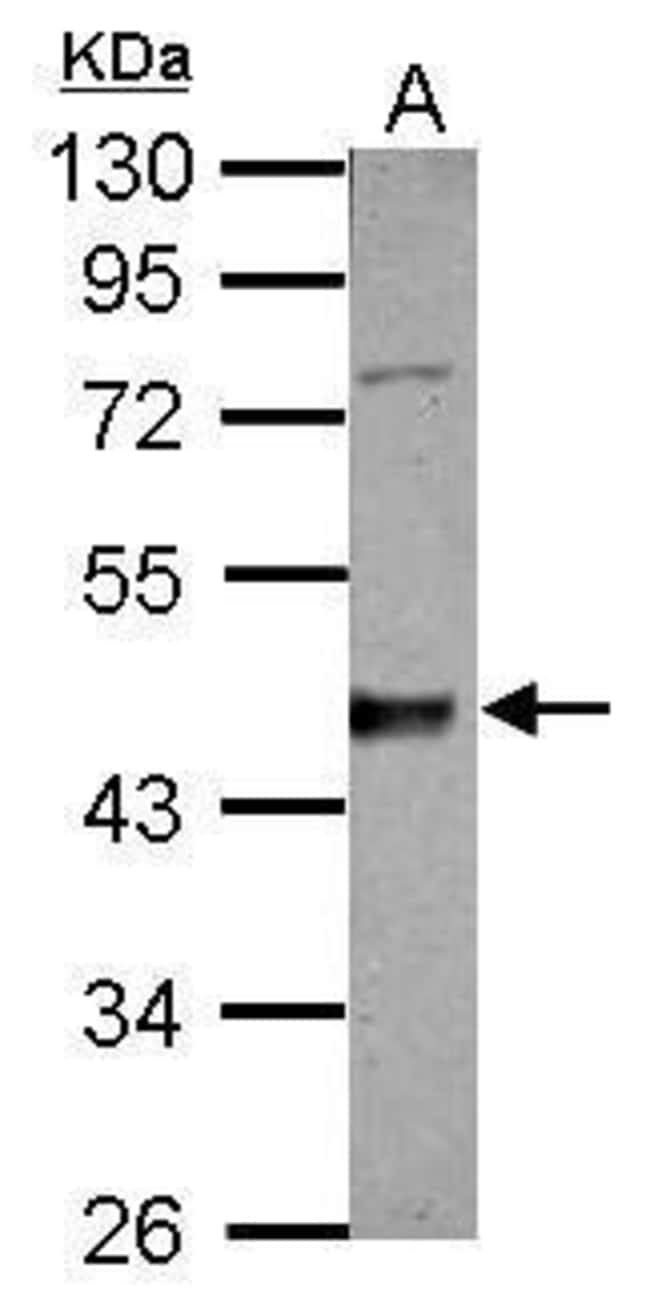 ANTI-CASEIN KINASE 1 DELTA