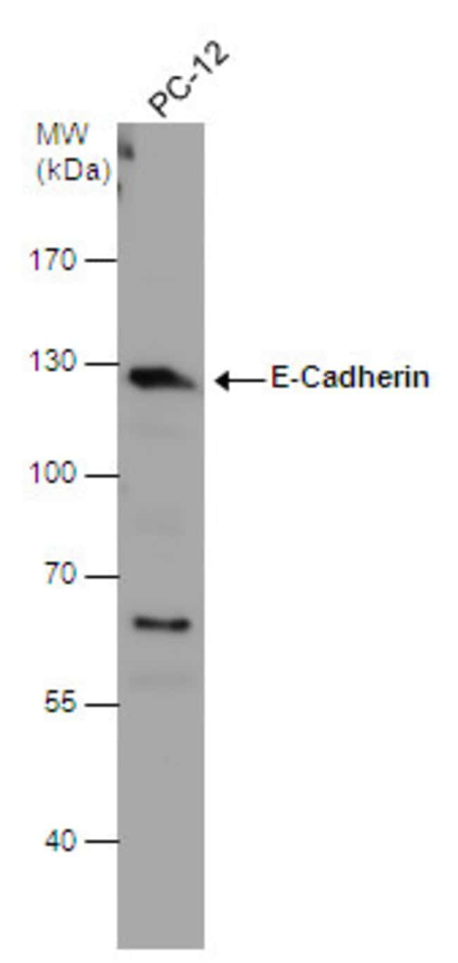 ANTI-E-CADHERIN