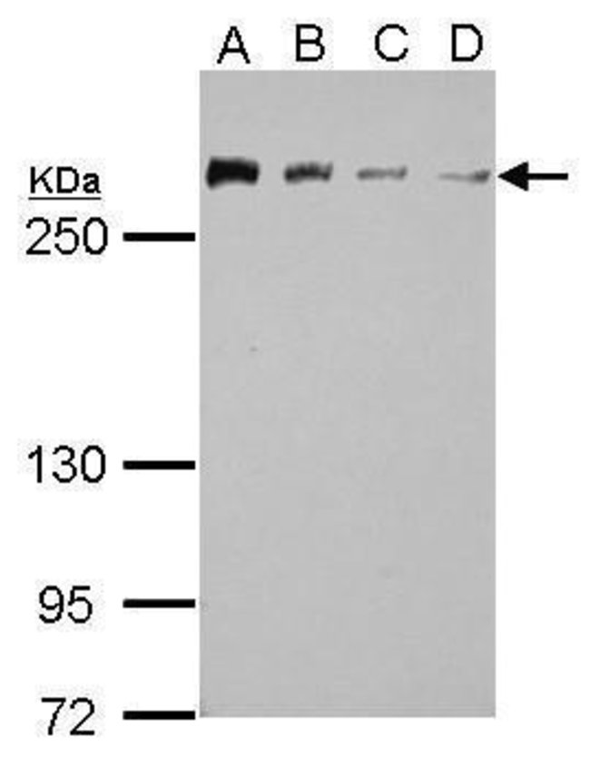 ANTI-CHD4