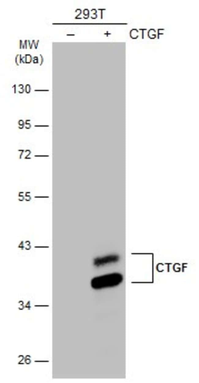 ANTI-CTGF