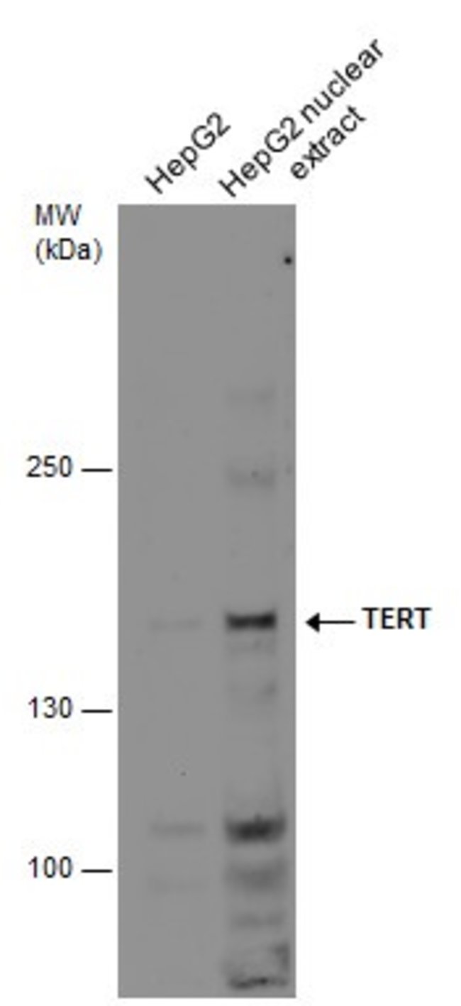 ANTI-TERT