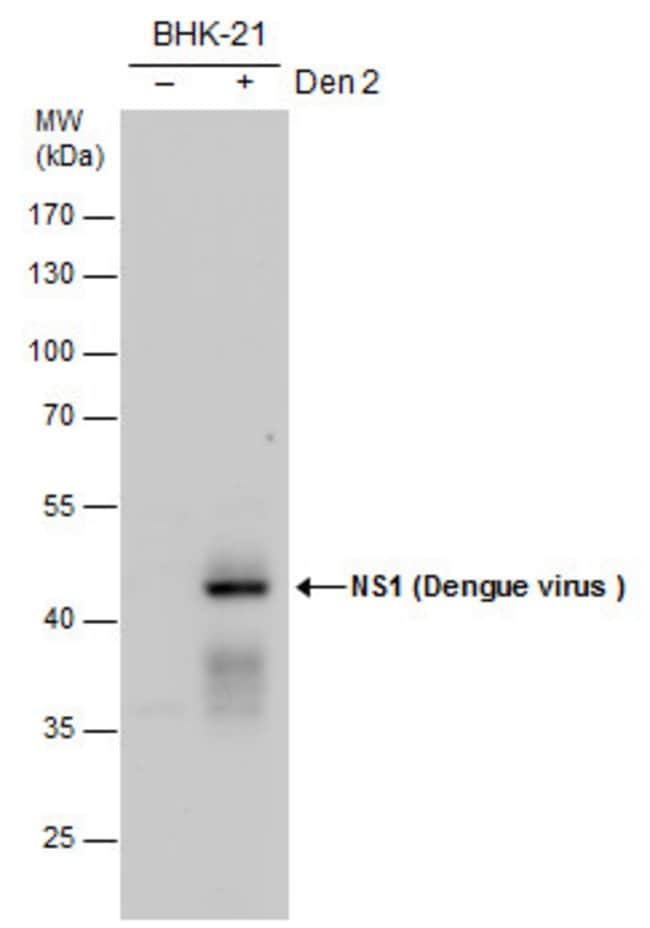 ANTI-NS1 (DENGUE VIRUS 2)