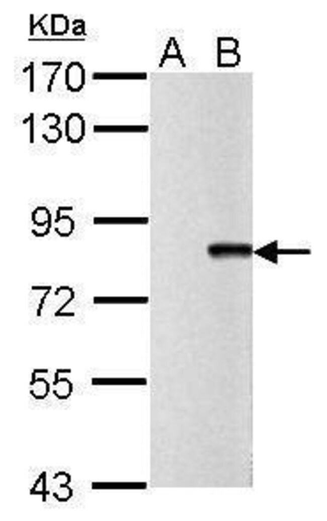 ANTI-ANTI-INFLUENZA A VIRUS PB2