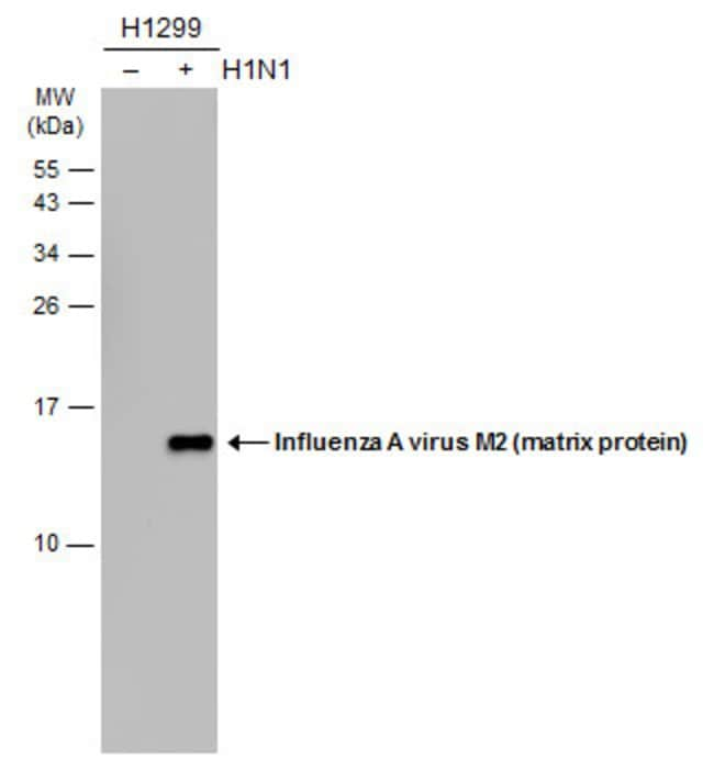 ANTI-INFLUENZA A VIRUS M2