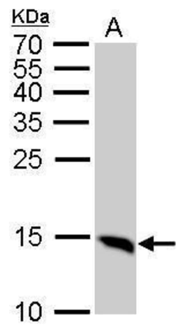 ANTI-LC3B1+LC3B2