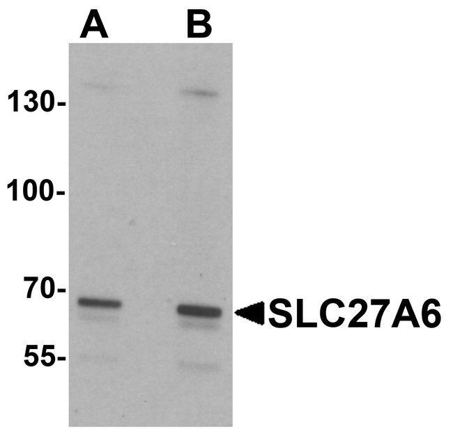 100UG SLC27A6 Antibody isotype IgG