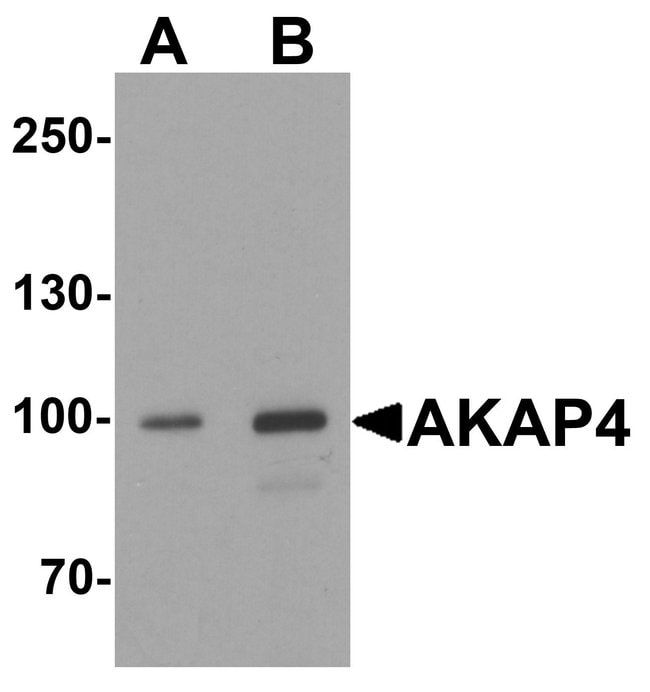 100UG AKAP4 Antibody