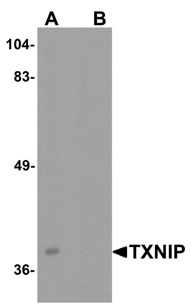 100UG BATF3 Antibody