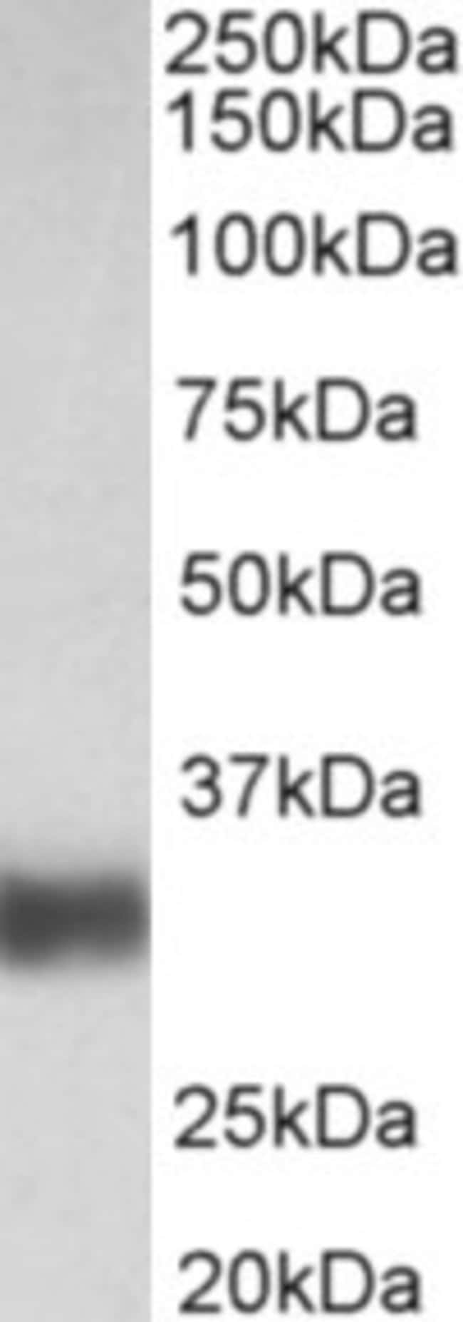 100 UG Surfactant Protein A1 + A2 Antibo