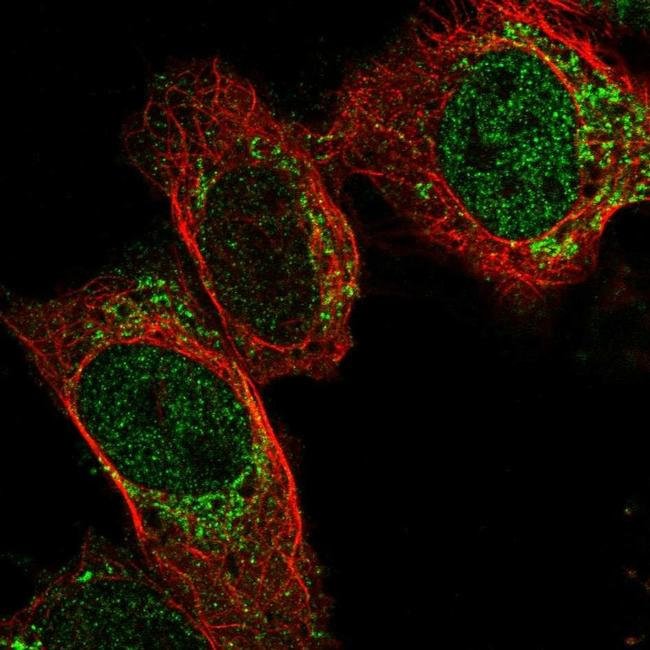 100UL PDF ANTIBODY