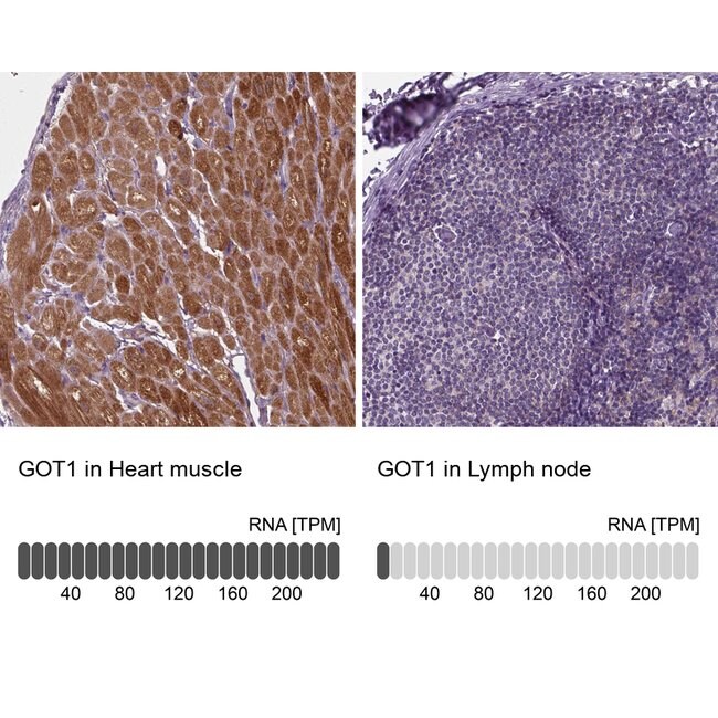 100 UL GOT1 Polyclonal Antibody