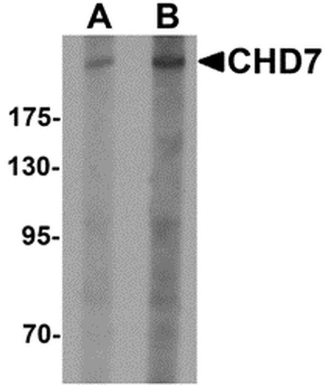 0.1MG CHD7 0.1 MG