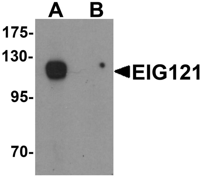 0.1MG EGI 0.1 MG