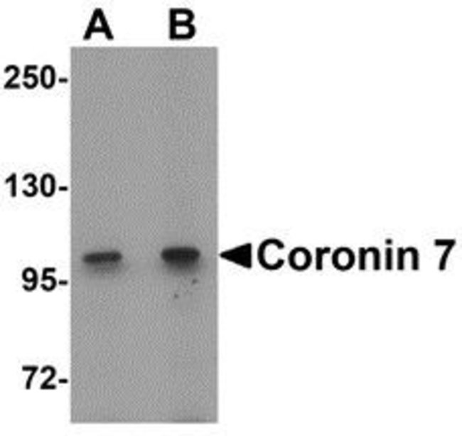 0.1MG CORONIN 7 0.1 MG