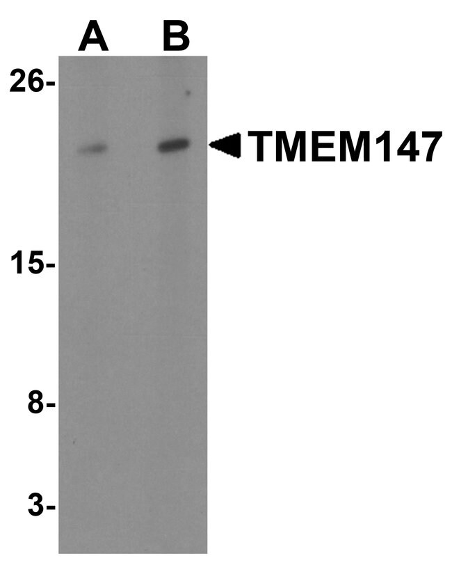 0.1MG TMEM147 0.1 MG