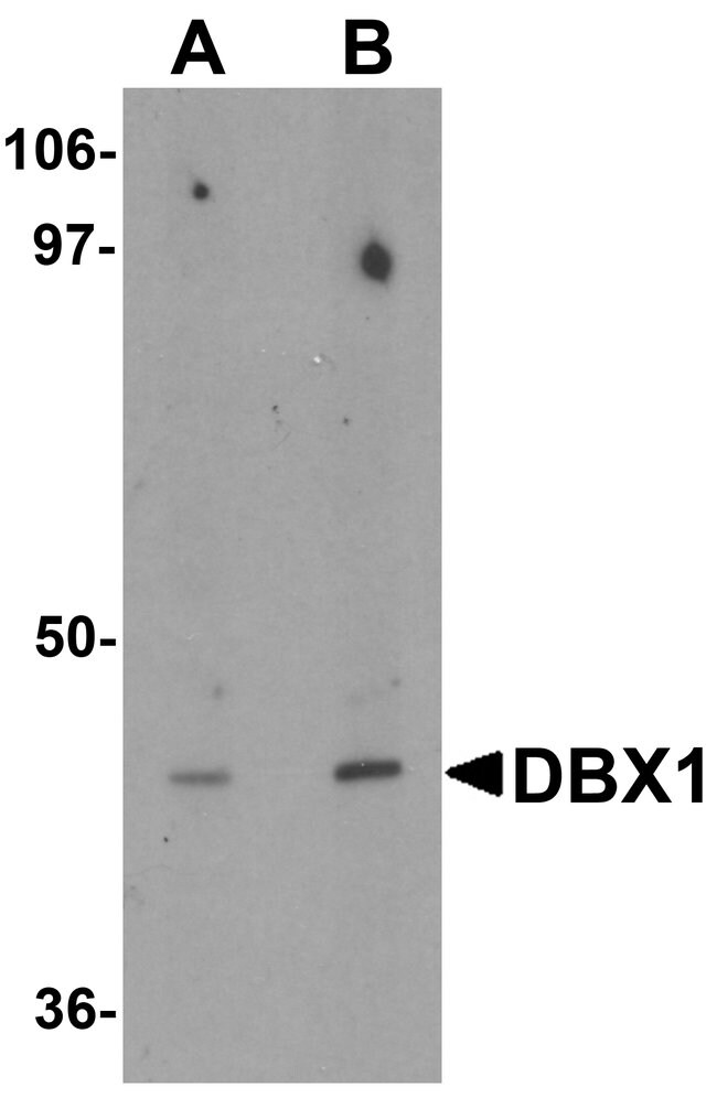 0.1MG DBX1 0.1 MG