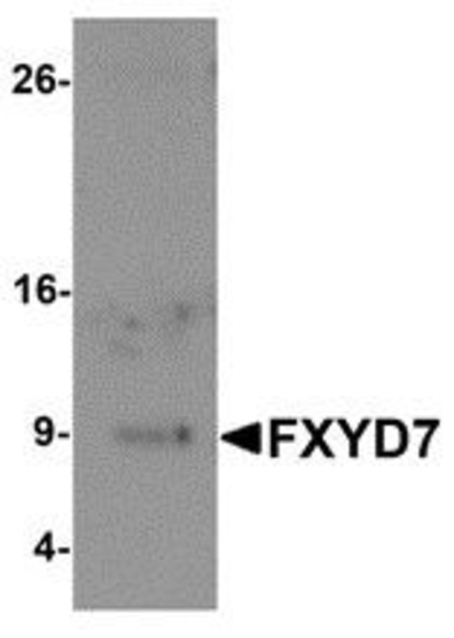 0.1MG FXYD7 0.1 MG