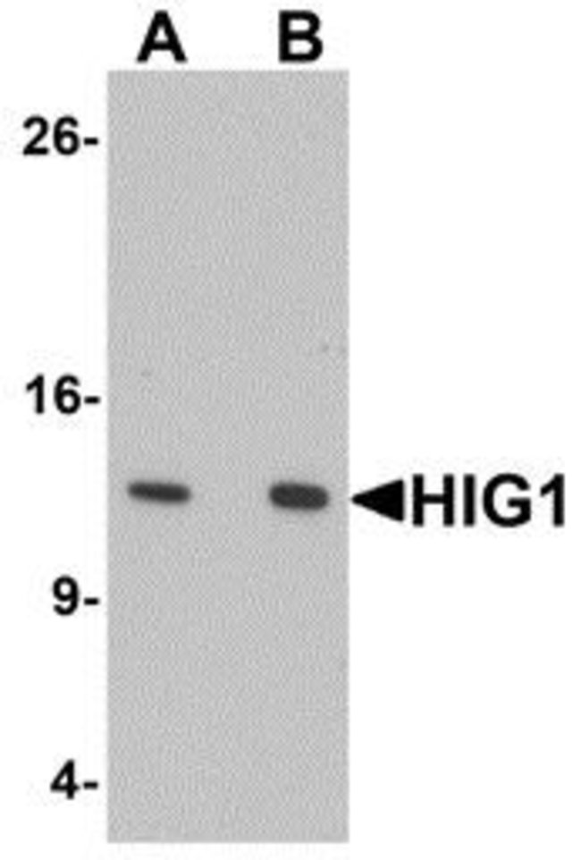 0.1MG HIGD1A 0.1 MG