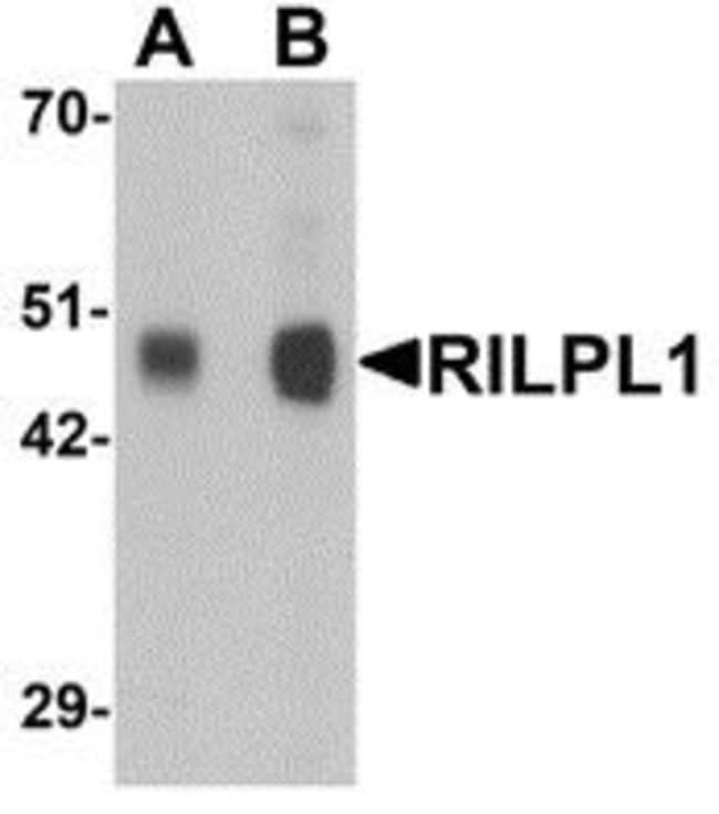 0.1MG RILPL1 0.1 MG