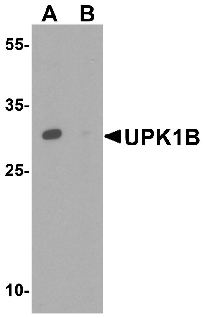 0.1MG UPK1B 0.1 MG