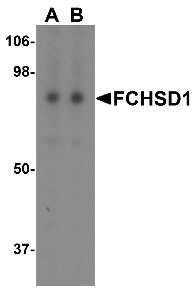 0.1MG FCHSD1 0.1 MG