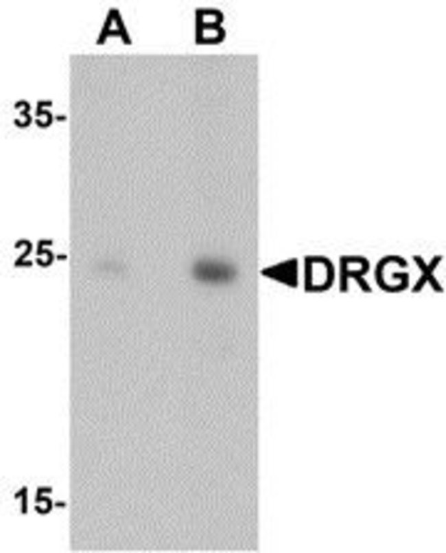 0.1MG DRGX 0.1 MG