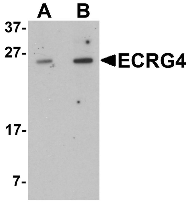 0.1MG ECRG4 0.1 MG