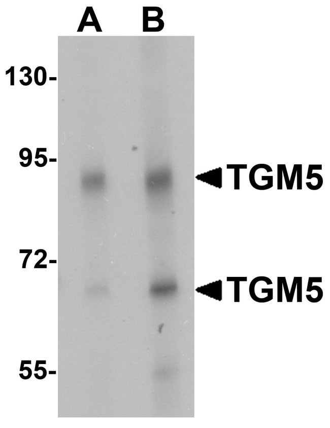 0.1MG TGM5 0.1 MG