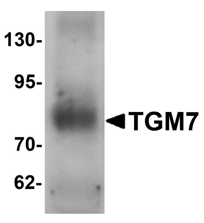 0.1MG TGM7 0.1 MG