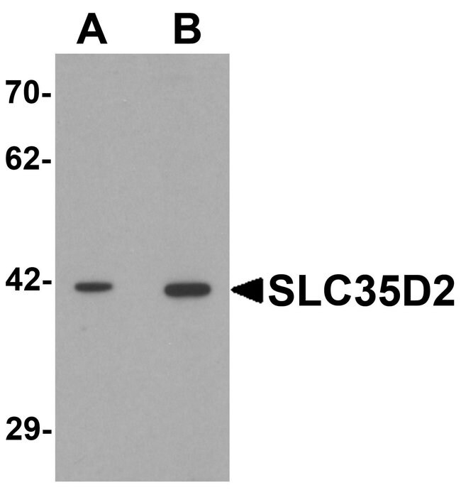 0.1MG SLC35D2 0.1 MG