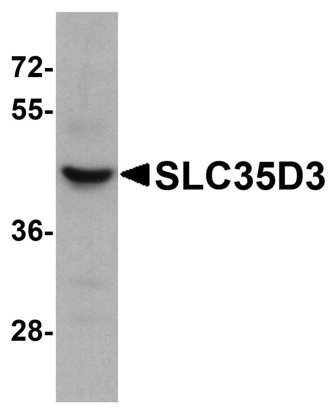 0.1MG SLC35D3 0.1 MG