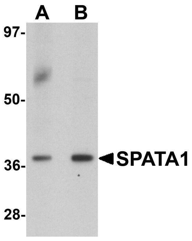 0.1MG SPATA1 0.1 MG