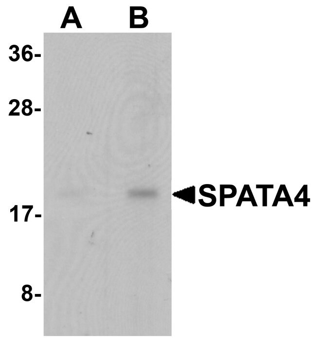 0.1MG SPATA4 0.1 MG