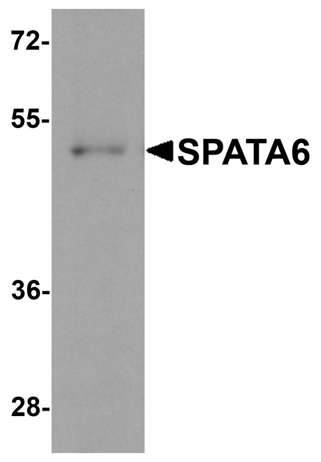 0.1MG SPATA6 0.1 MG