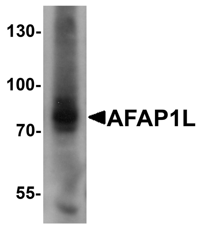 0.1MG AFAP1L1 0.1 MG