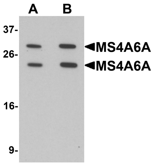 0.1MG MS4A6A 0.1 MG