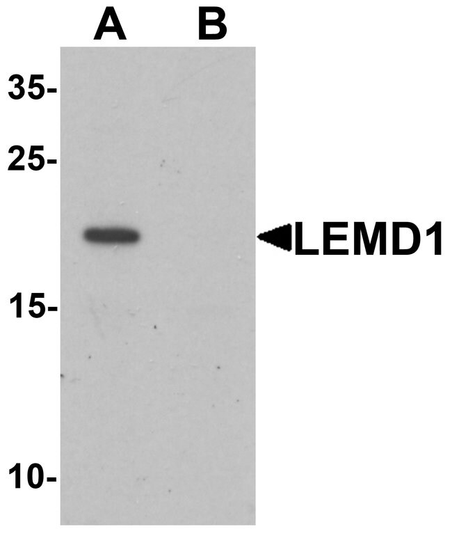 0.1MG LEMD1 0.1 MG