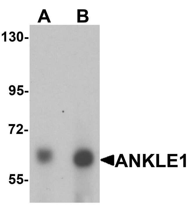 0.1MG ANKLE1 0.1 MG