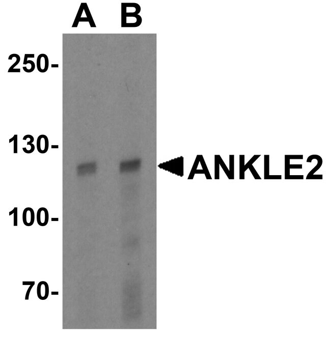 0.1MG ANKLE2 0.1 MG