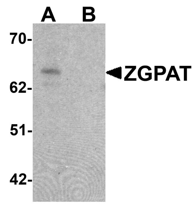 0.1MG ZGPAT 0.1 MG