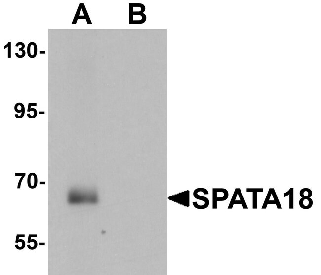 0.1MG SPATA18 0.1 MG