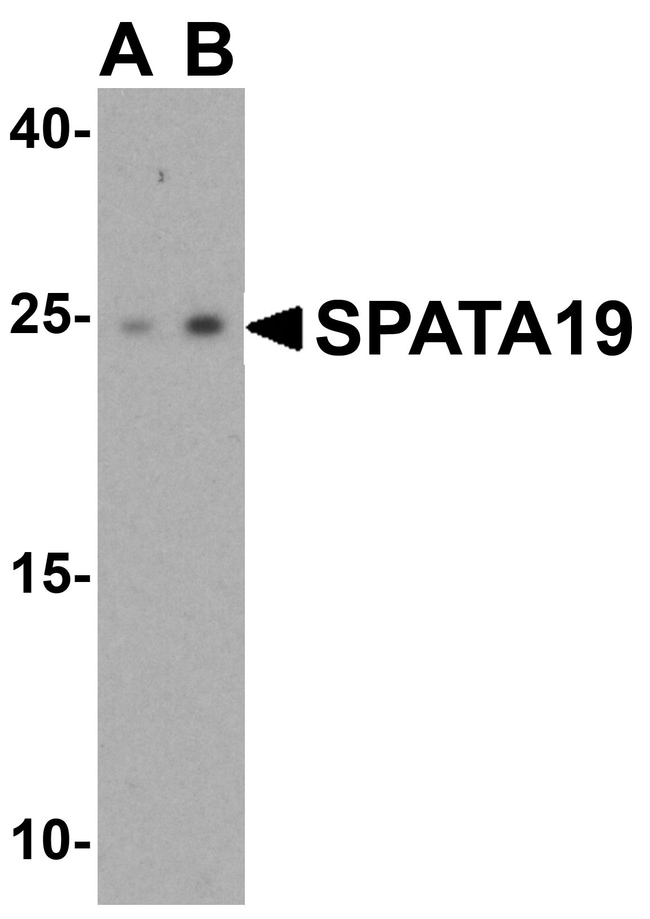 0.1MG SPATA19 0.1 MG