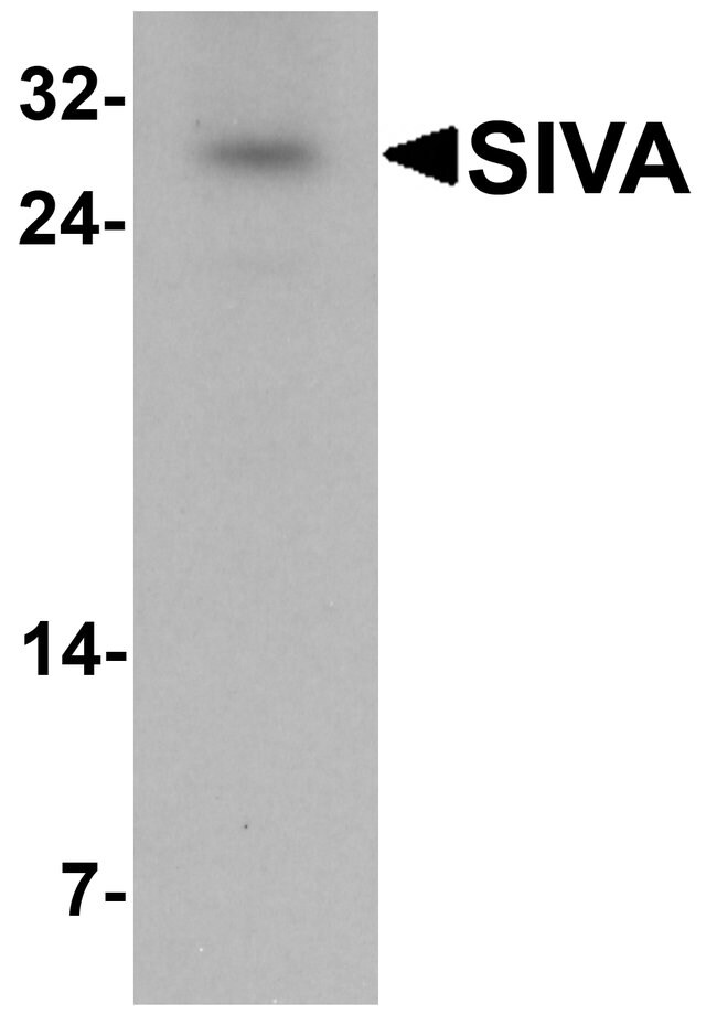 0.1MG SIVA1 0.1 MG