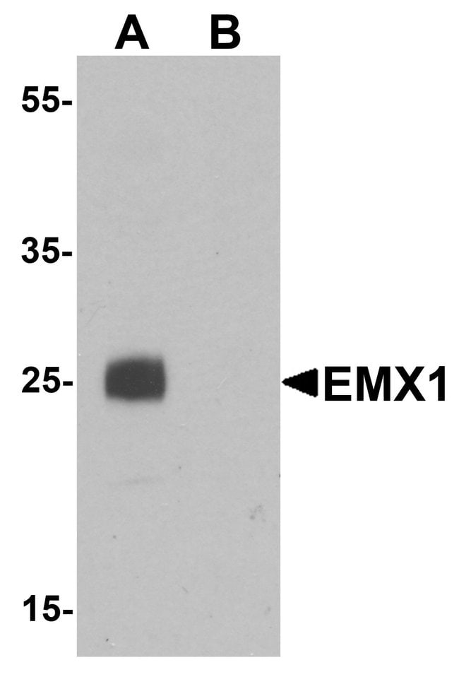 0.1MG EMX1 0.1 MG