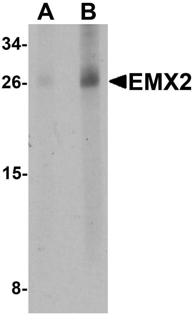 0.1MG EMX2 0.1 MG