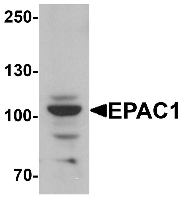 0.1MG RAPGEF3 0.1 MG