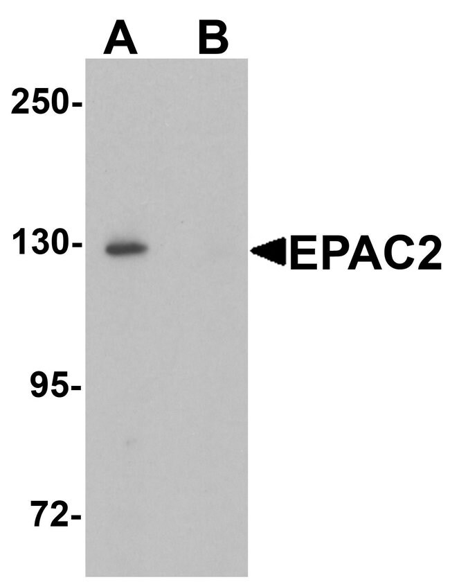 0.1MG RAPGEF4 0.1 MG